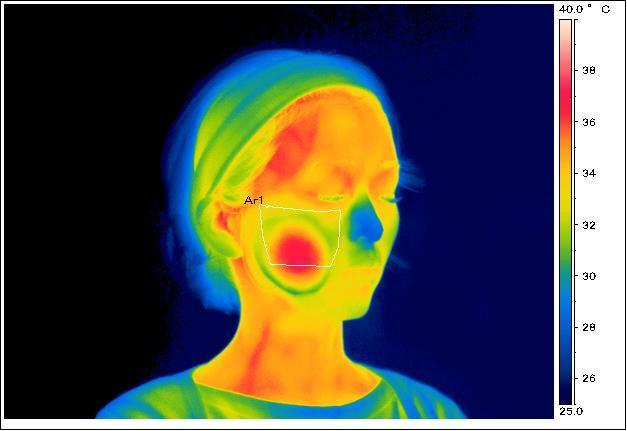 お家で続けるエステ風美容♡売り上げランキング１位の美顔器は、お肌が若返る気がする＊にて紹介している画像